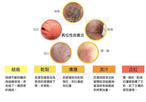 皮膚問題照片